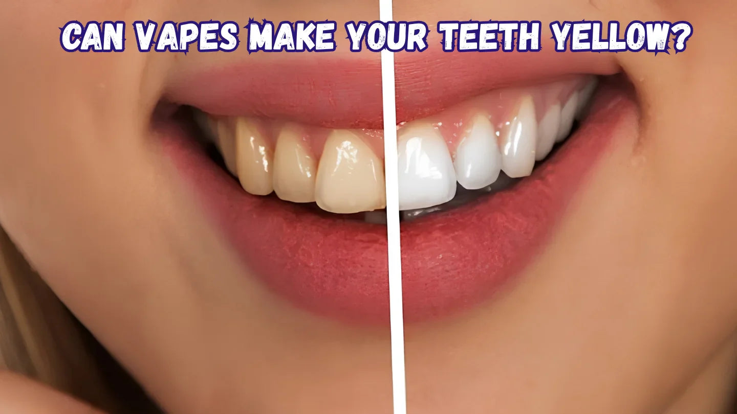 Can Vapes Make Your Teeth Yellow? Prevention & Reversal Can Vapes Make Your Teeth Yellow? Prevention & Reversal
